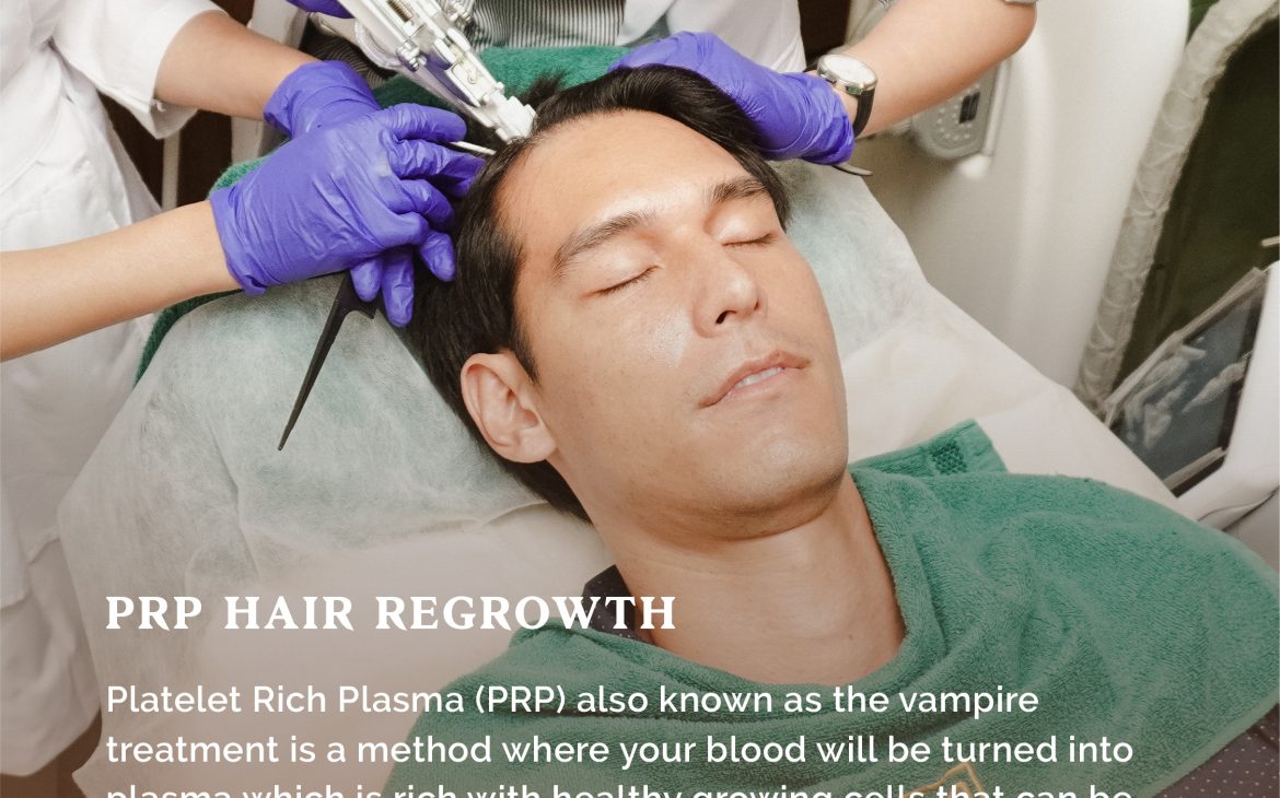 Rambut Rontok Akibat Stres? Gampang, Atasi Dengan Treatment PRP dari zap Clinic!