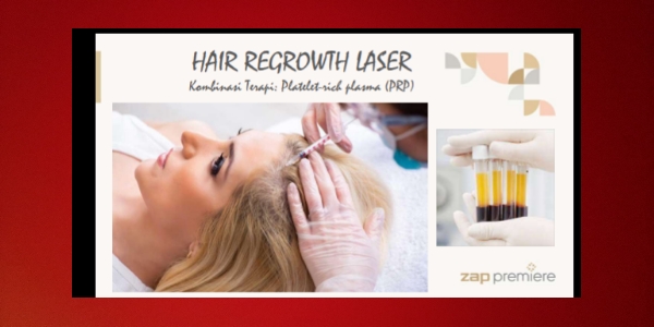 Saatnya Merenov Mahkota dari Tuhan dengan treatment Hair Regrowth Laser Persembahan ZAP Clinic