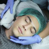 Kenalan dengan  ULTHERMAGE, Perawatan pilihan Luna Maya : Kombinasi Teknologi lifting termewah tanpa operasi